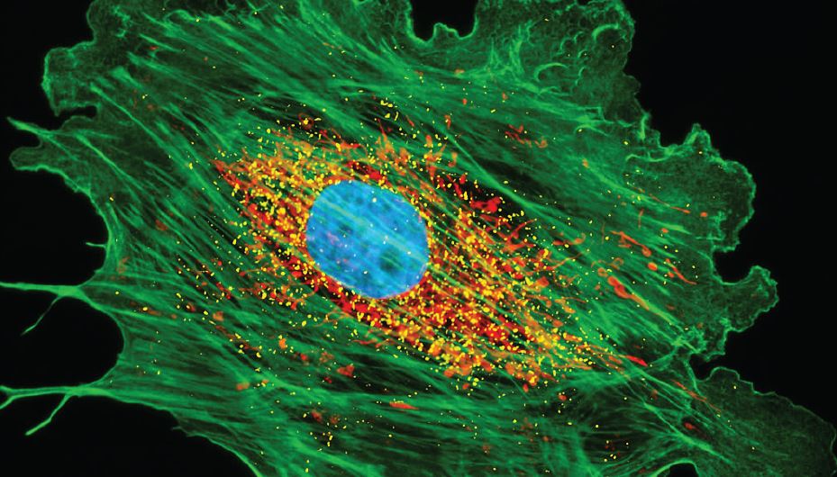 cell viewed with custom microscope objective